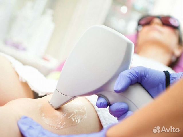 Лазерная эпиляция лучшая