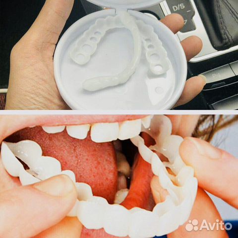 Виниры Snap-On Smile Виниры Snap-On Smile
