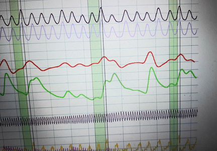 Проверка на полиграфе, скрининг